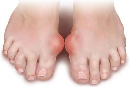 ������ ������� ��� 