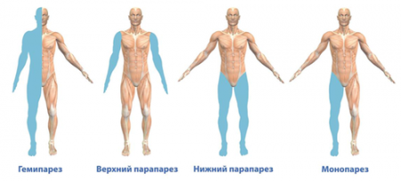 ������� �����������