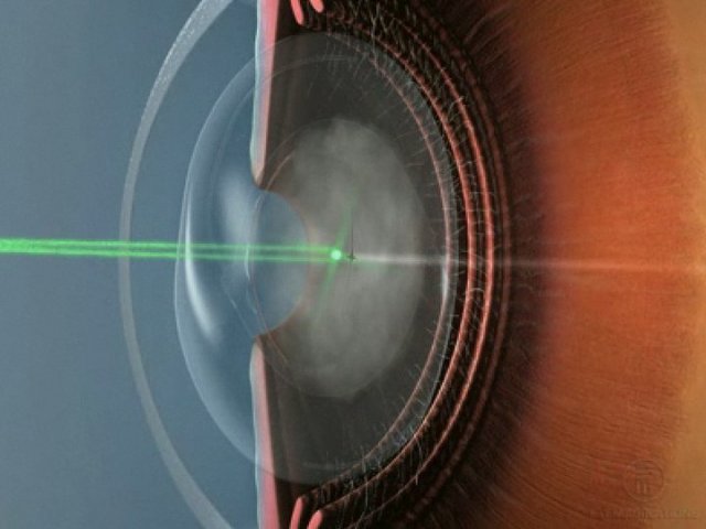 ��� ����� ��������� ���������?