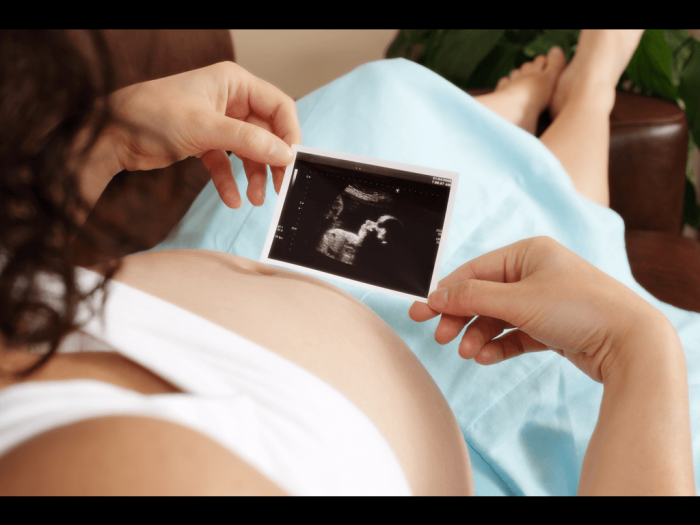 ���������� ����������� ������ ����� � ��������������� �����������